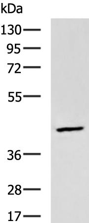 兔抗DNASE2多克隆抗体