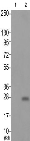 兔抗CCR5(Phospho-Ser349)多克隆抗体