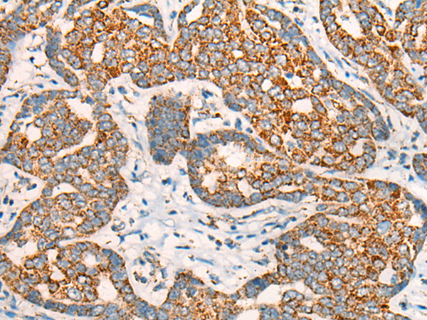 兔抗CCT8L2多克隆抗体