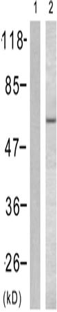 兔抗DOK1(phospho-Tyr398)多克隆抗体
