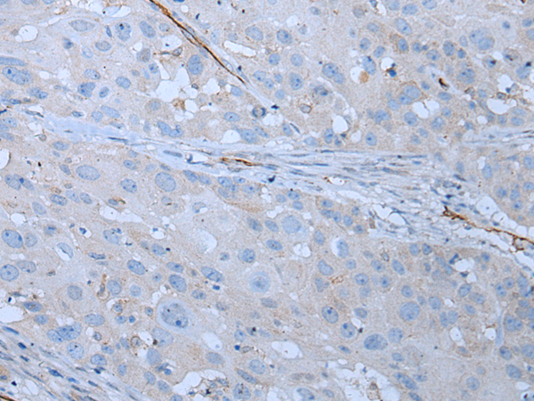 兔抗CD34多克隆抗体