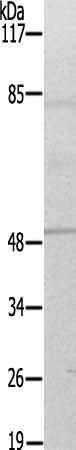 兔抗DPYSL2(Ab-509)多克隆抗体
