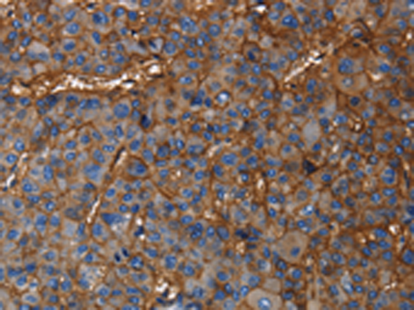 兔抗CD46多克隆抗体