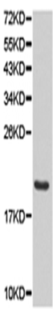 兔抗CD70多克隆抗体