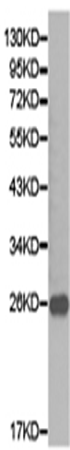 兔抗CD79B多克隆抗体