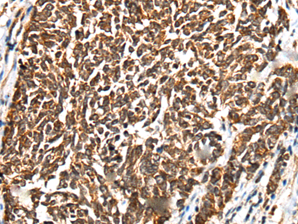 兔抗CD101多克隆抗体