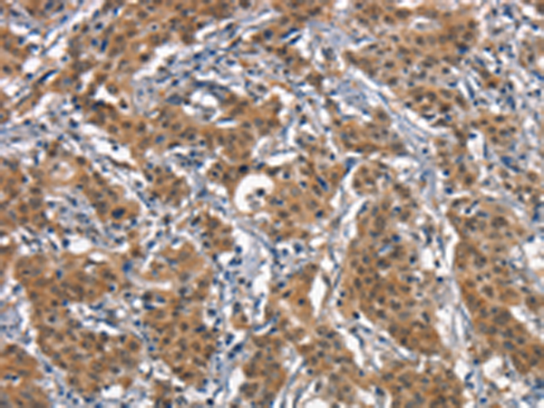 兔抗CD163多克隆抗体
