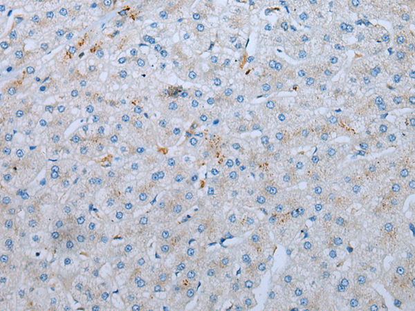 兔抗CD209多克隆抗体