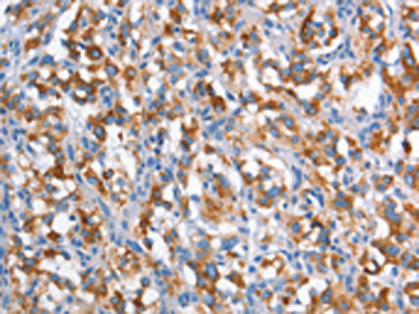 兔抗CD226多克隆抗体
