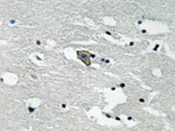 兔抗FLT1(Phospho-Tyr1048)多克隆抗体 