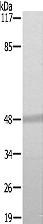兔抗FOS(Ab-232)多克隆抗体