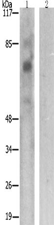 兔抗FOXO1/3/4(Phospho-Thr24/32)多克隆抗体