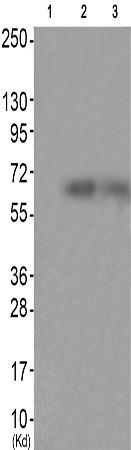 兔抗FRS2(Phospho-Tyr436)多克隆抗体