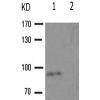 兔抗FLT1(Phospho-Tyr1213)多克隆抗体