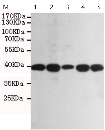 小鼠抗RAD51单克隆抗体  