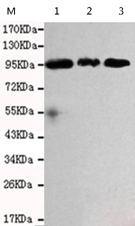 小鼠抗RANBP9单克隆抗体 