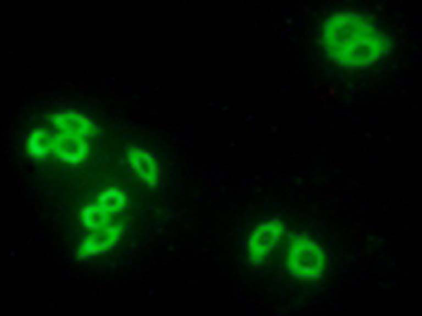 兔抗TNFAIP8多克隆抗体