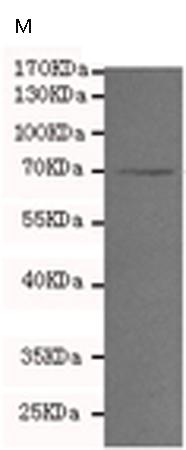 小鼠抗MMP2单克隆抗体 