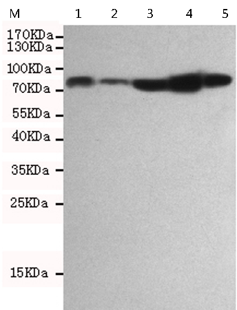 小鼠抗RPS6KA1单克隆抗体   
