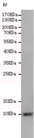 小鼠抗S100B单克隆抗体