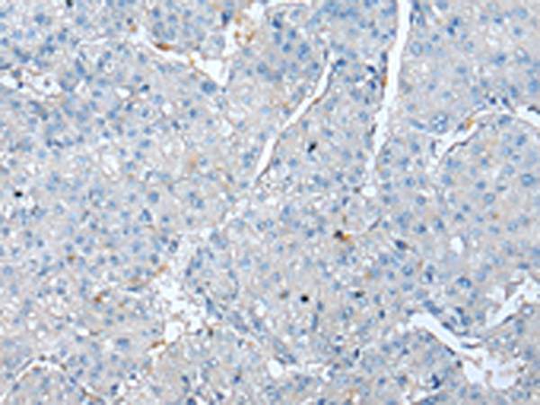 兔抗TPM4多克隆抗体