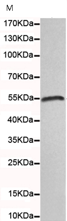 小鼠抗SMYD1单克隆抗体 