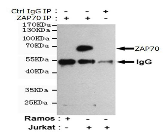 小鼠抗ZAP70单克隆抗体   