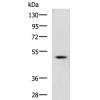 兔抗TMPRSS11D多克隆抗体