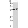 兔抗TMPRSS11F多克隆抗体