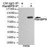 小鼠抗RANBP9单克隆抗体 