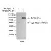 小鼠抗RPS6KA1单克隆抗体   