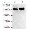 小鼠抗TRIM33单克隆抗体  