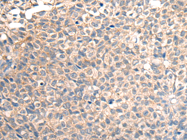 兔抗TNFRSF10D多克隆抗体