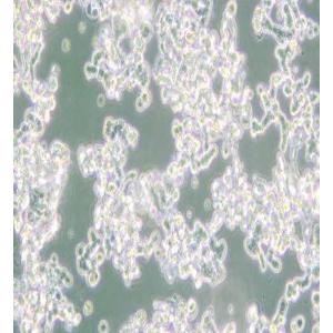 WERI-Rb-1人视网膜神经胶质瘤细胞