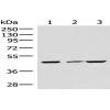 Anti-IP6K2 antibody