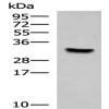 Anti-KCTD7 antibody