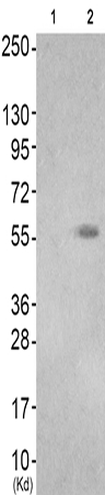 兔抗TPH2(Ab-19) 多克隆抗体