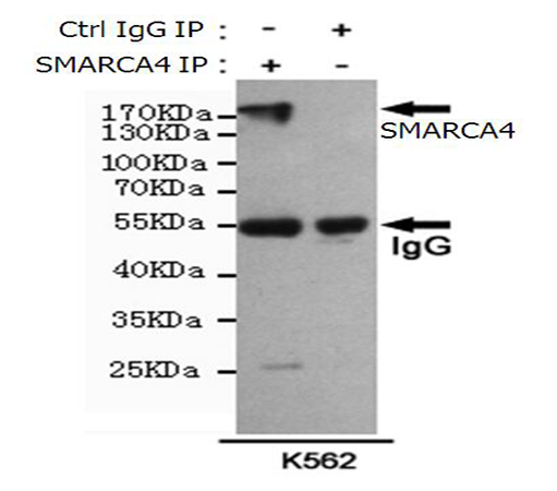 小鼠抗SMARCA4单克隆抗体