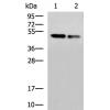 小鼠抗TP53单克隆抗体