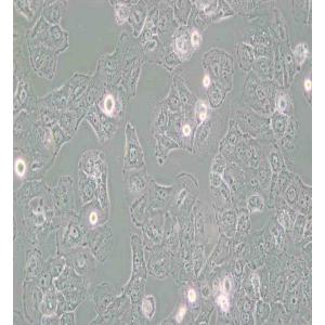 Caov-3人乳突状卵巢腺癌细胞