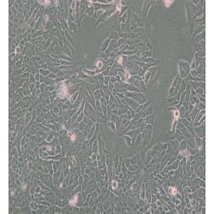 MDA-MB-361人乳腺癌细胞(DMEM) 