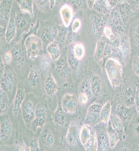 NCI-H661人大细胞肺癌细胞主图