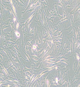 NCI-H2452[H2452]人间皮瘤细胞主图