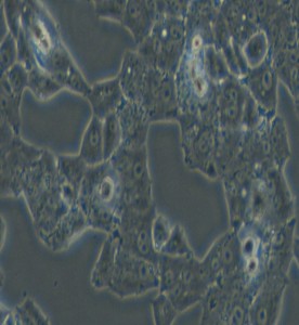 NCI-H1395人肺腺癌细胞主图