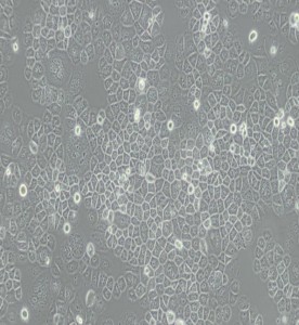 SW-13人肾上腺皮质小细胞癌细胞(L15)主图