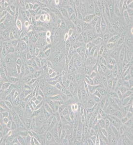 TPC-1人甲状腺癌细胞主图