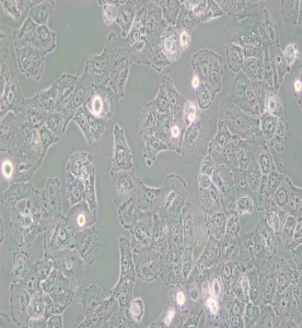 Caov-3人乳突状卵巢腺癌细胞主图