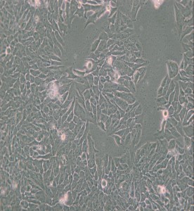 MDA-MB-361人乳腺癌细胞(L15) 主图