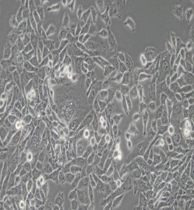 MDA-MB-415人乳腺癌细胞(L15) 主图