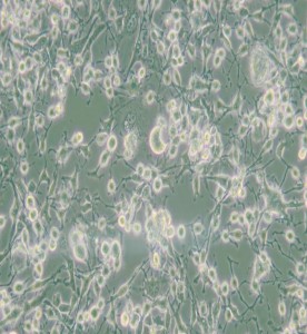 MDA-MB-436人乳腺癌细胞(L15)主图
